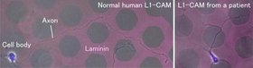 Mutation in CRASH syndrome leads to dysfunction of the grip & slip mechanism and disrupts laminin-induced axonal haptotaxis.