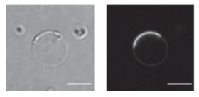 Micrograph of GAS7 protein assembled on giant membrane vesicle. On the left is a transmission micrograph of an artificial lipid membrane (giant vesicles) used in the research. On the right is the GAS7 protein (fluorescent protein GFP is fused for observat